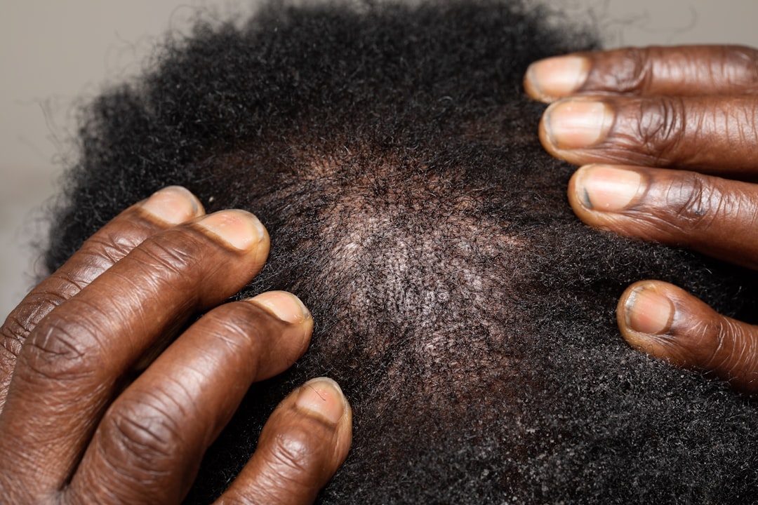 Close-up scalp analysis showing hair health and scalp condition