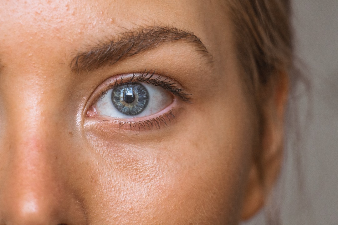 Close-up of healthy under-eye skin showing results of collagen treatment