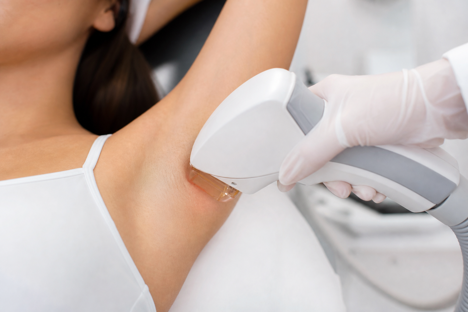 Close-up of laser hair removal treatment on underarm area showing professional technique